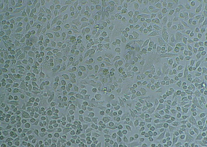 RT-112 Cell:人膀胱癌细胞系,RT-112 Cell