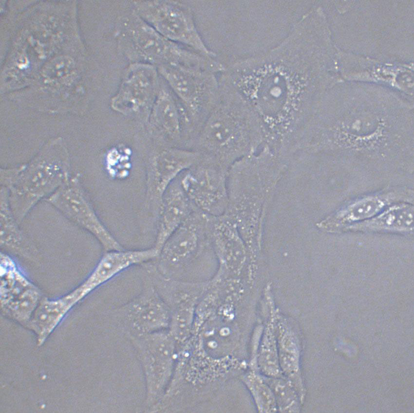 IGROV-1 Cell:人卵巢癌细胞系,IGROV-1 Cell