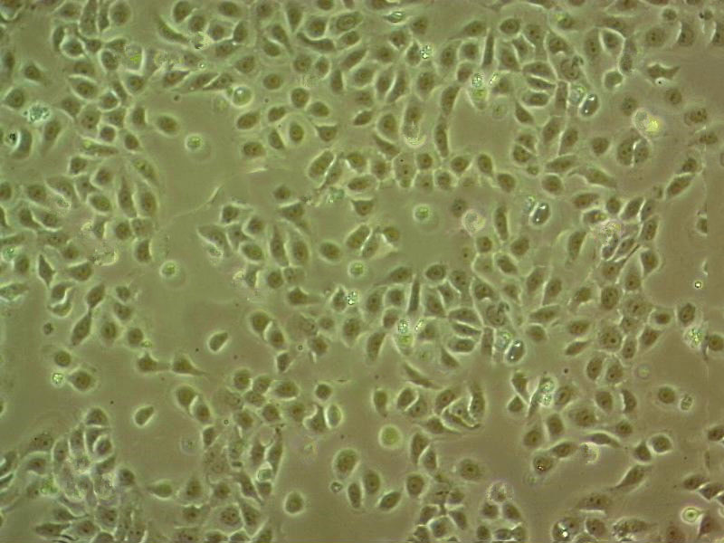 FM88 Cell:人黑色素瘤细胞系,FM88 Cell