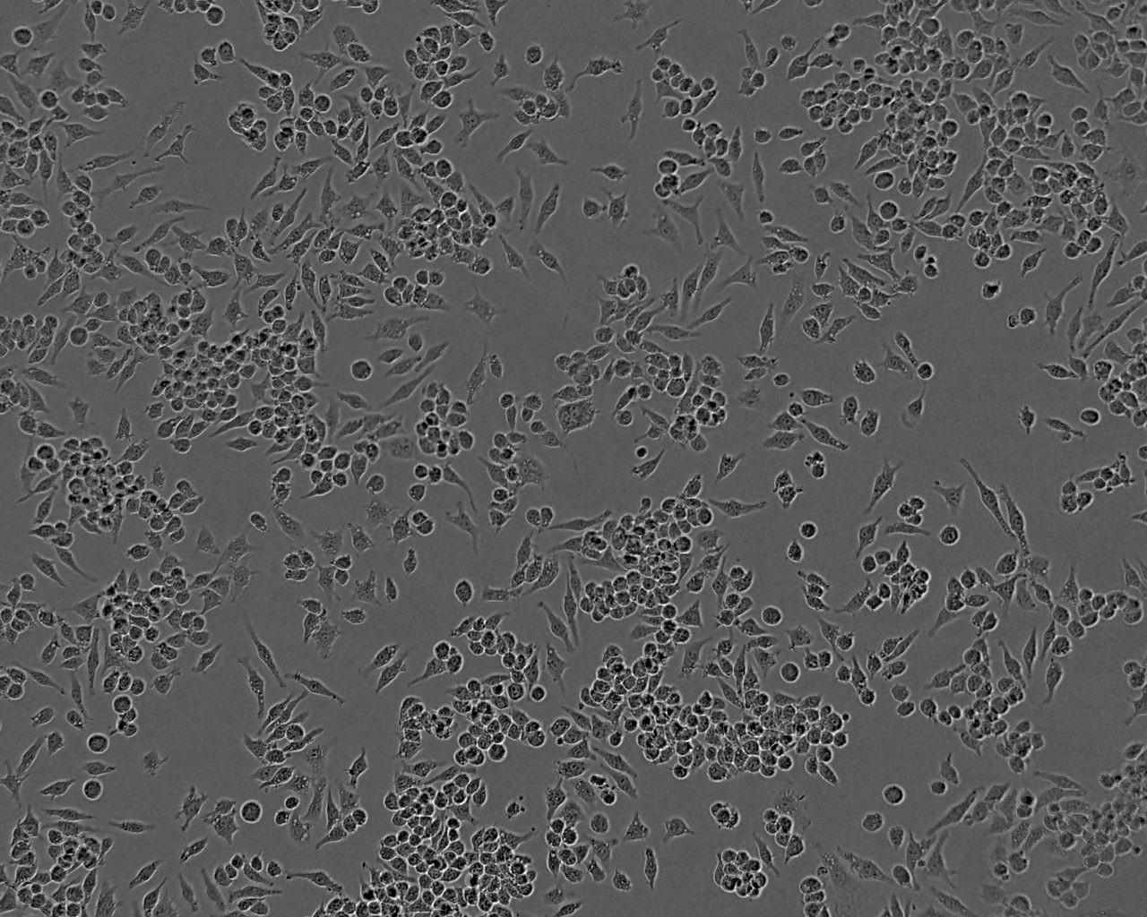 HCC9724 Cell:人肝癌细胞系,HCC9724 Cell