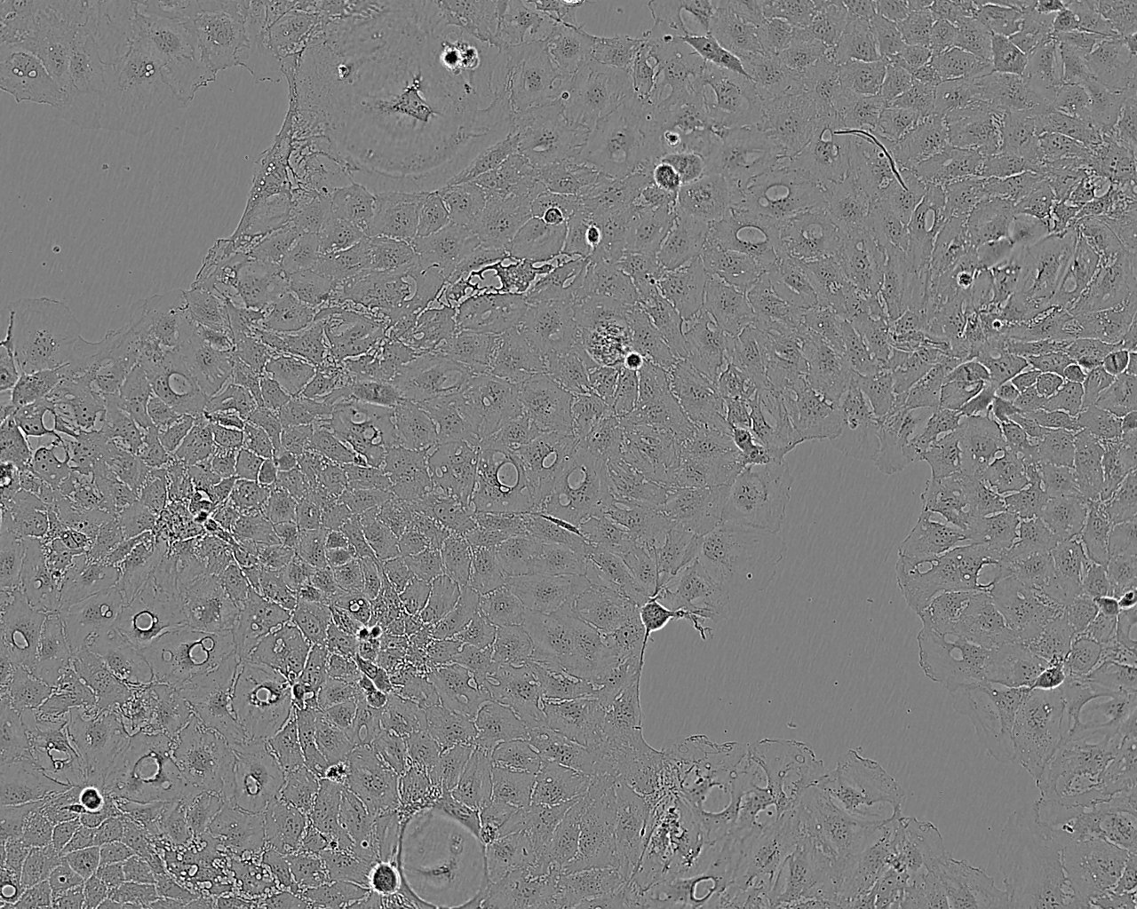 JCA-1 Cell:人前列腺癌细胞系,JCA-1 Cell