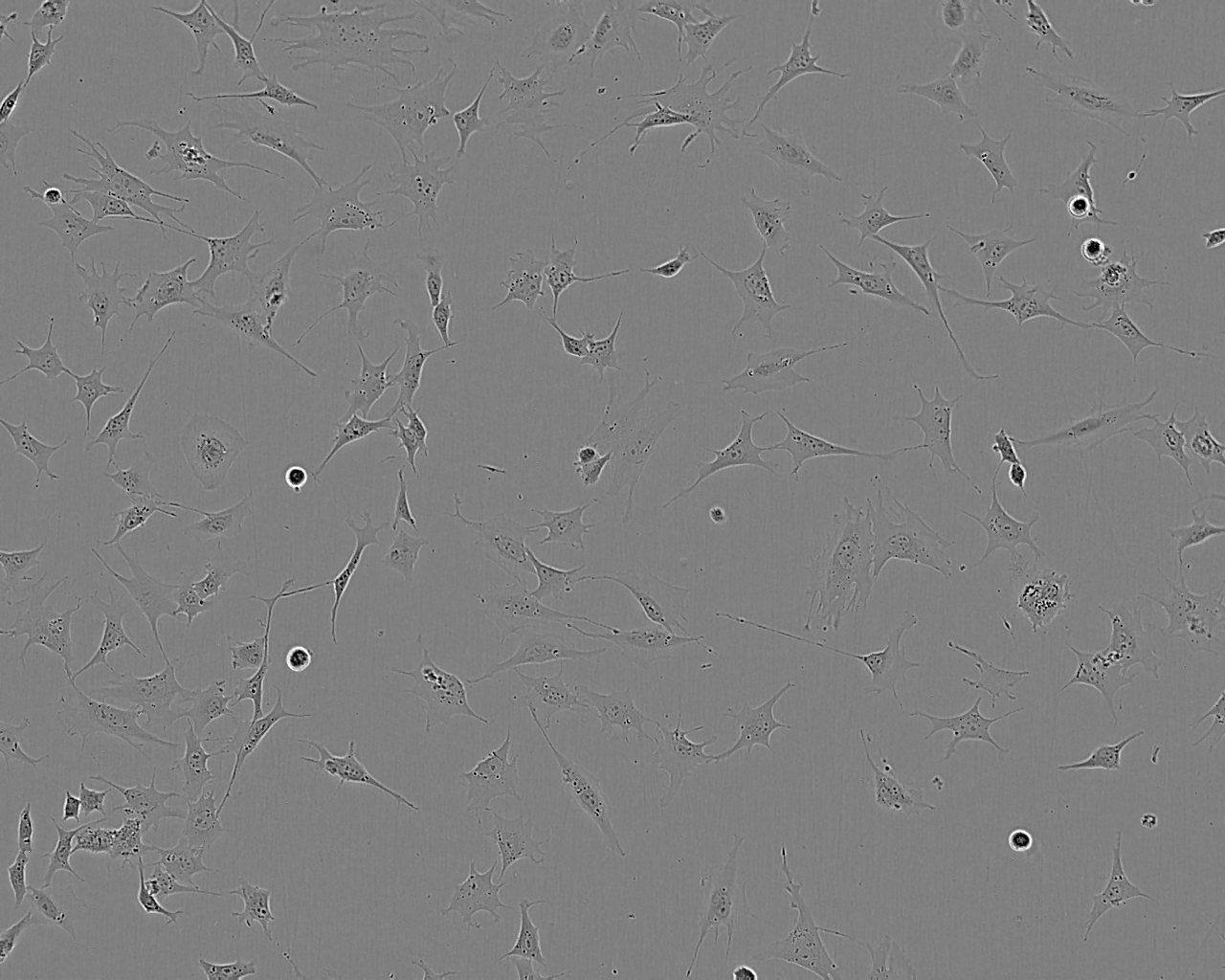 U-118MG Cell:人脑星形胶质母细胞系,U-118MG Cell