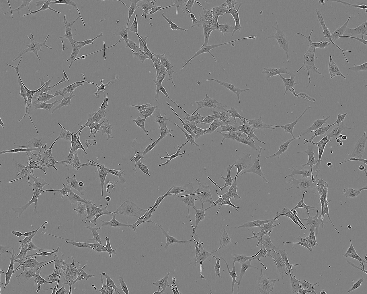 COR-L26 Cell:人肺癌细胞系,COR-L26 Cell