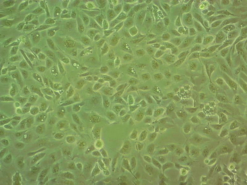 SK-MEL-5 Cell:人恶性黑色素瘤细胞系,SK-MEL-5 Cell