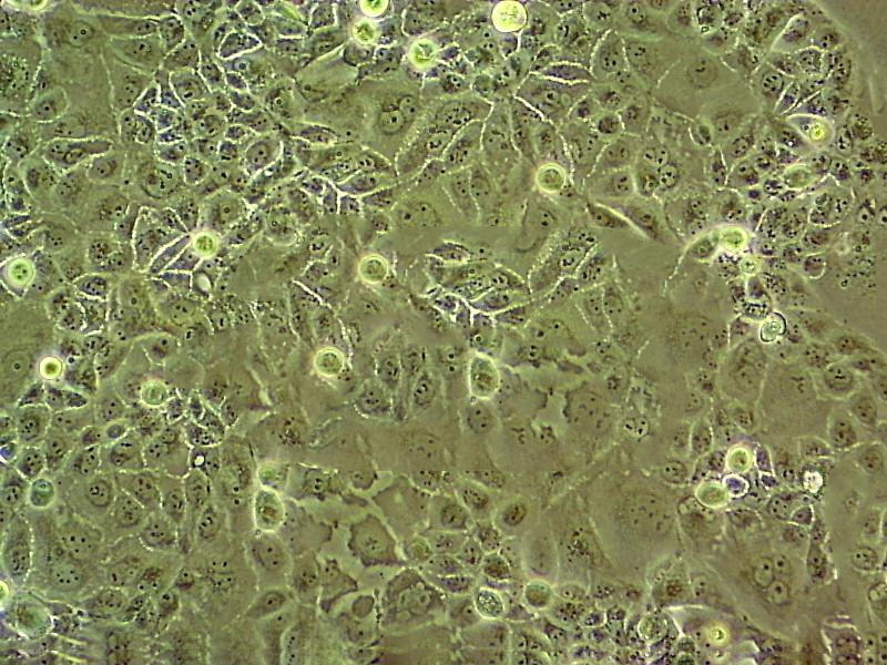 HSC-3 Cell:人口腔鳞癌细胞系,HSC-3 Cell