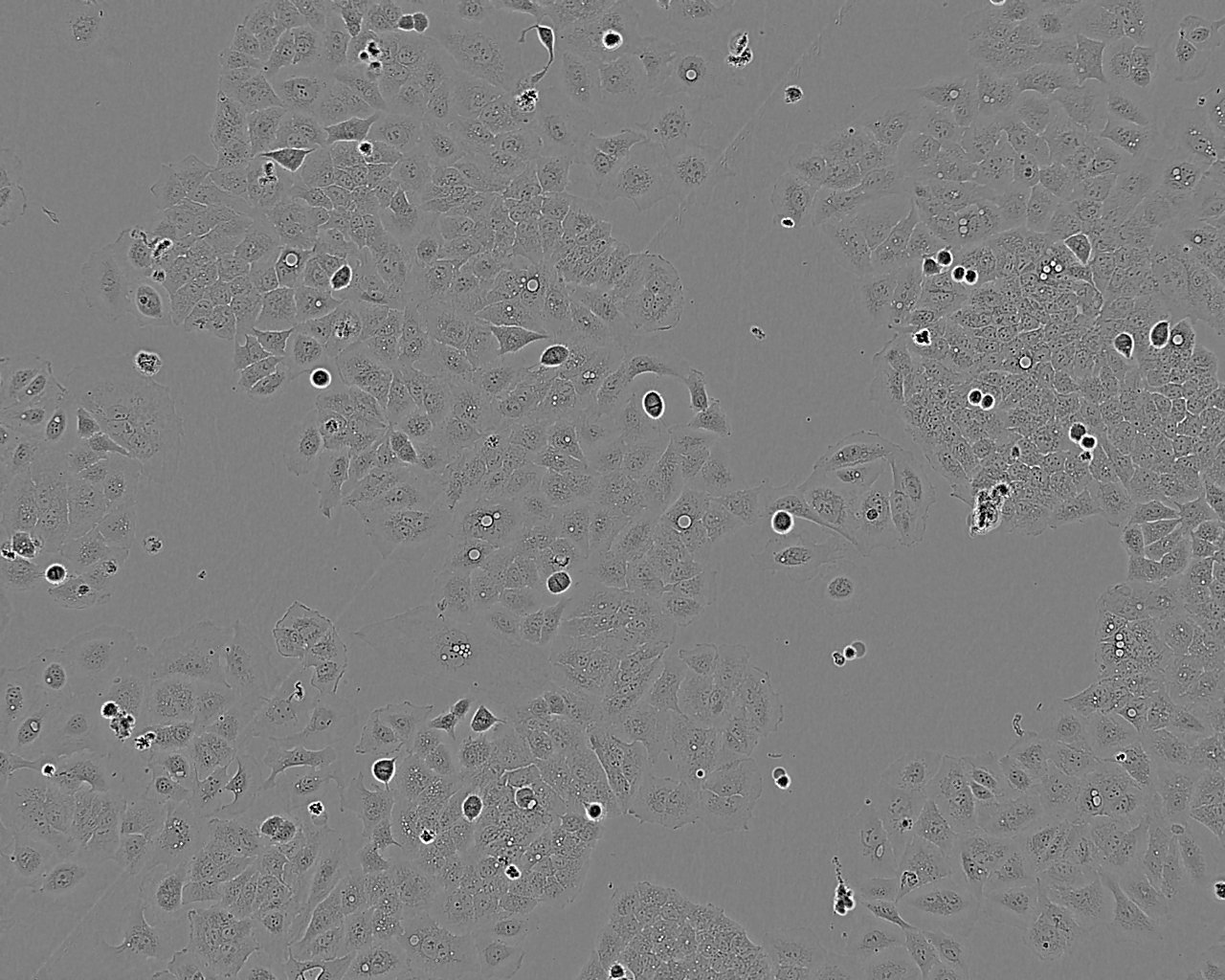 SCC-25 Cell:人口腔鳞癌细胞系,SCC-25 Cell