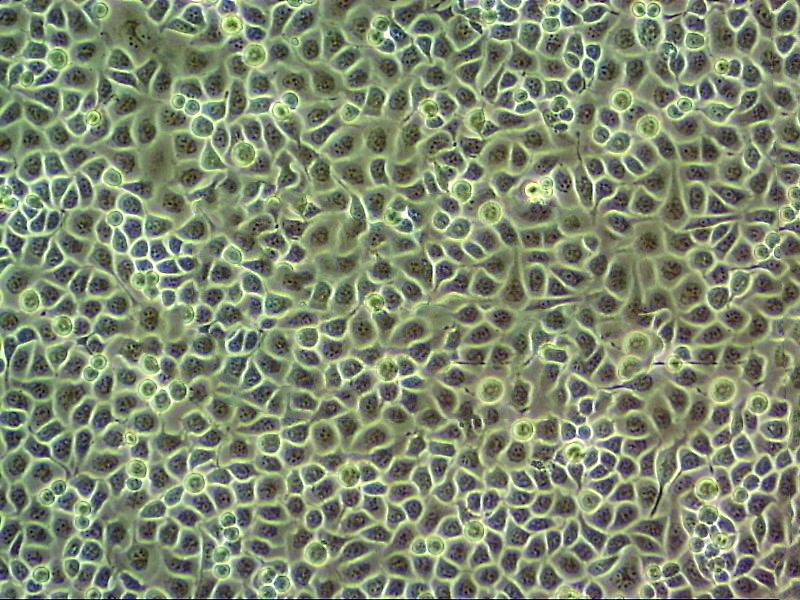 RT-4 Cell:人膀胱移行细胞乳头瘤细胞系,RT-4 Cell