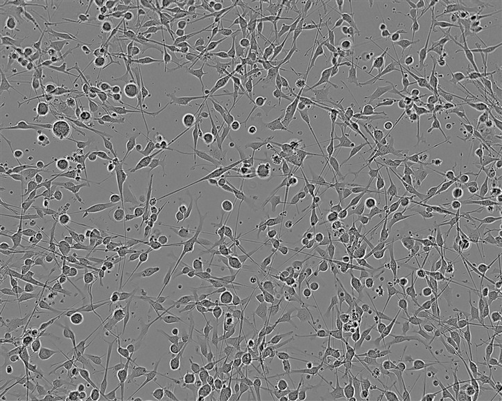 SK-UT-1 Cell:人子宫内膜癌细胞系,SK-UT-1 Cell