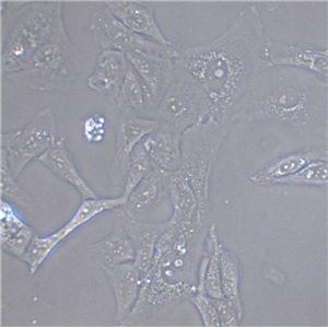 IGROV-1 Cell:人卵巢癌细胞系