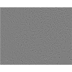 SW982 Cell:人滑膜肉瘤细胞系