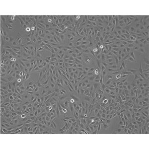 KLM-1 Cell:人胰腺癌细胞系,KLM-1 Cell