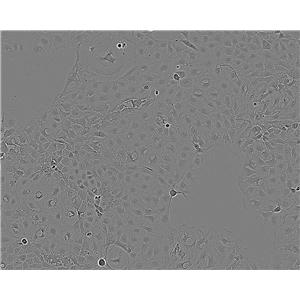 JCA-1 Cell:人前列腺癌细胞系