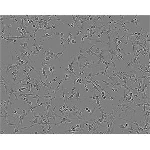 SW1271 Cell:人肺腺癌细胞系