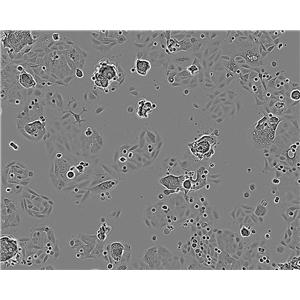 OKa-C-1 Cell:人低分化肺癌鳞癌细胞系