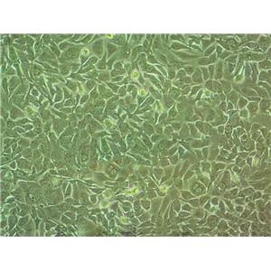HT-1197 Cell:人膀胱癌细胞系