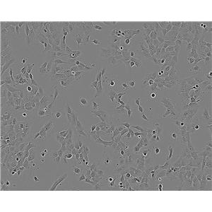 AAV-293 Cell:腺病毒转化的人胚肾细胞系