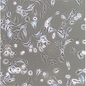 人急性髓细胞白血病细胞；SHI-1