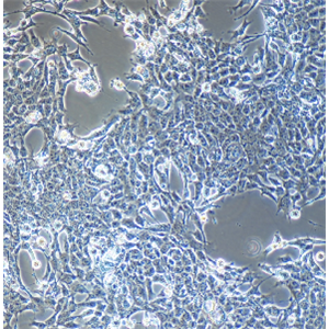 人恶性多发性畸胎瘤细胞；NTERA-2