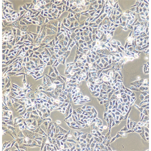 人恶性非霍奇金淋巴瘤患者的自然杀伤细胞；NK-92/MI