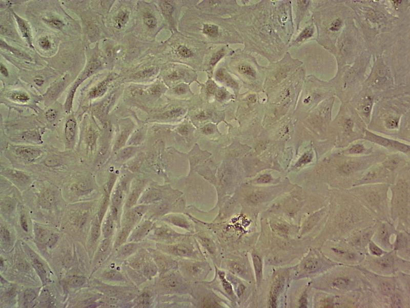 M14 Cell:人黑色素瘤细胞系,M14 Cell