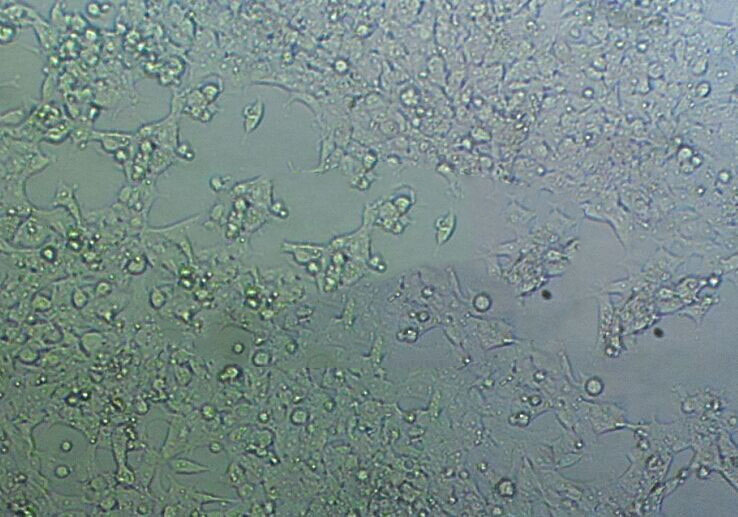 MX-1 Cell:人乳腺癌细胞系,MX-1 Cell