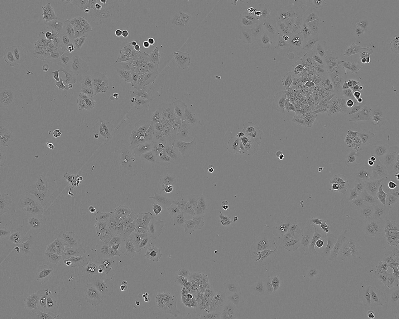 NCI-H1299 Cell:人非小细胞肺癌细胞系,NCI-H1299 Cell