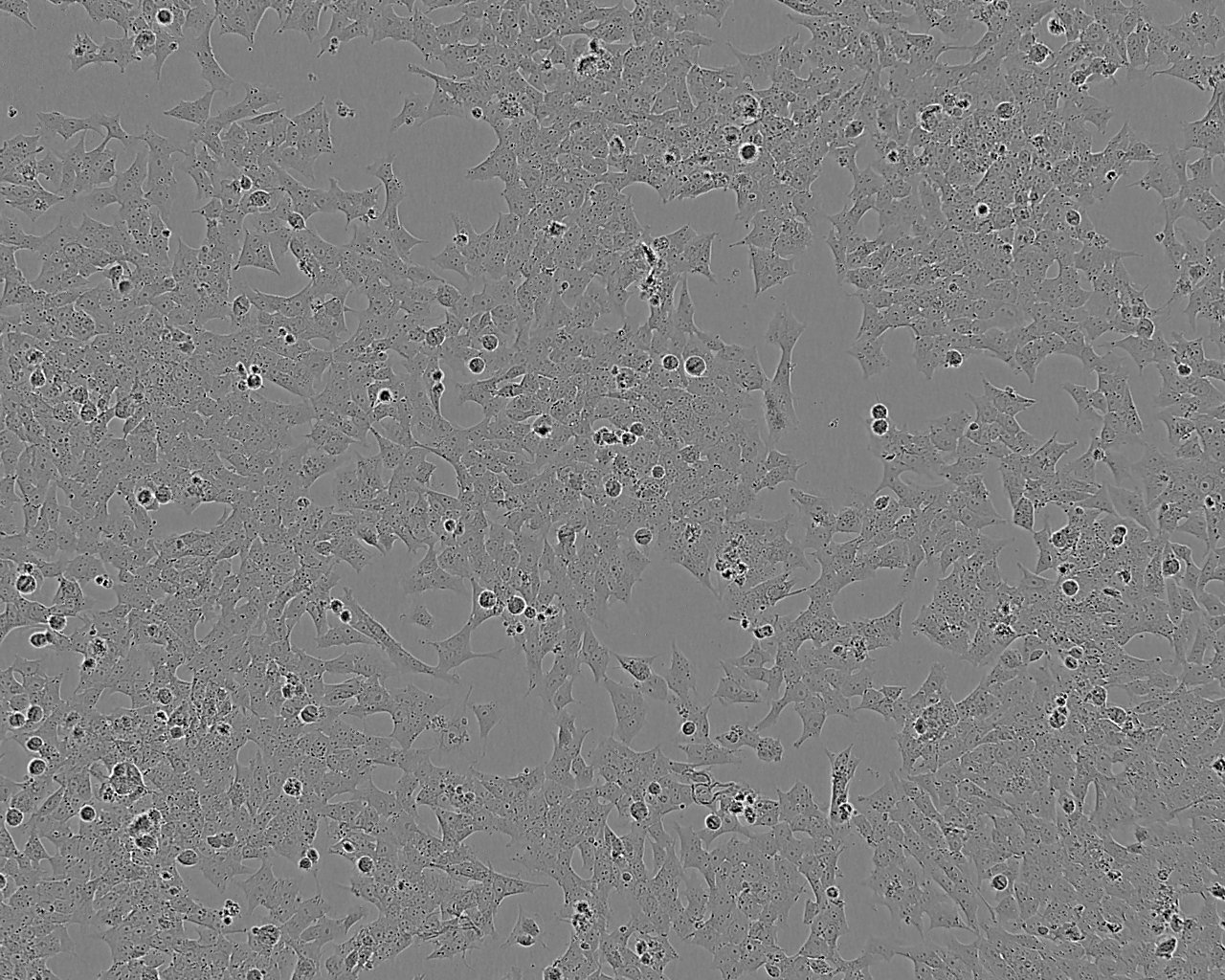 NCM356 Cell:结直肠腺癌细胞系,NCM356 Cell