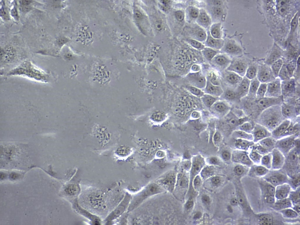 SNU-761 Cell:人肝癌细胞系,SNU-761 Cell