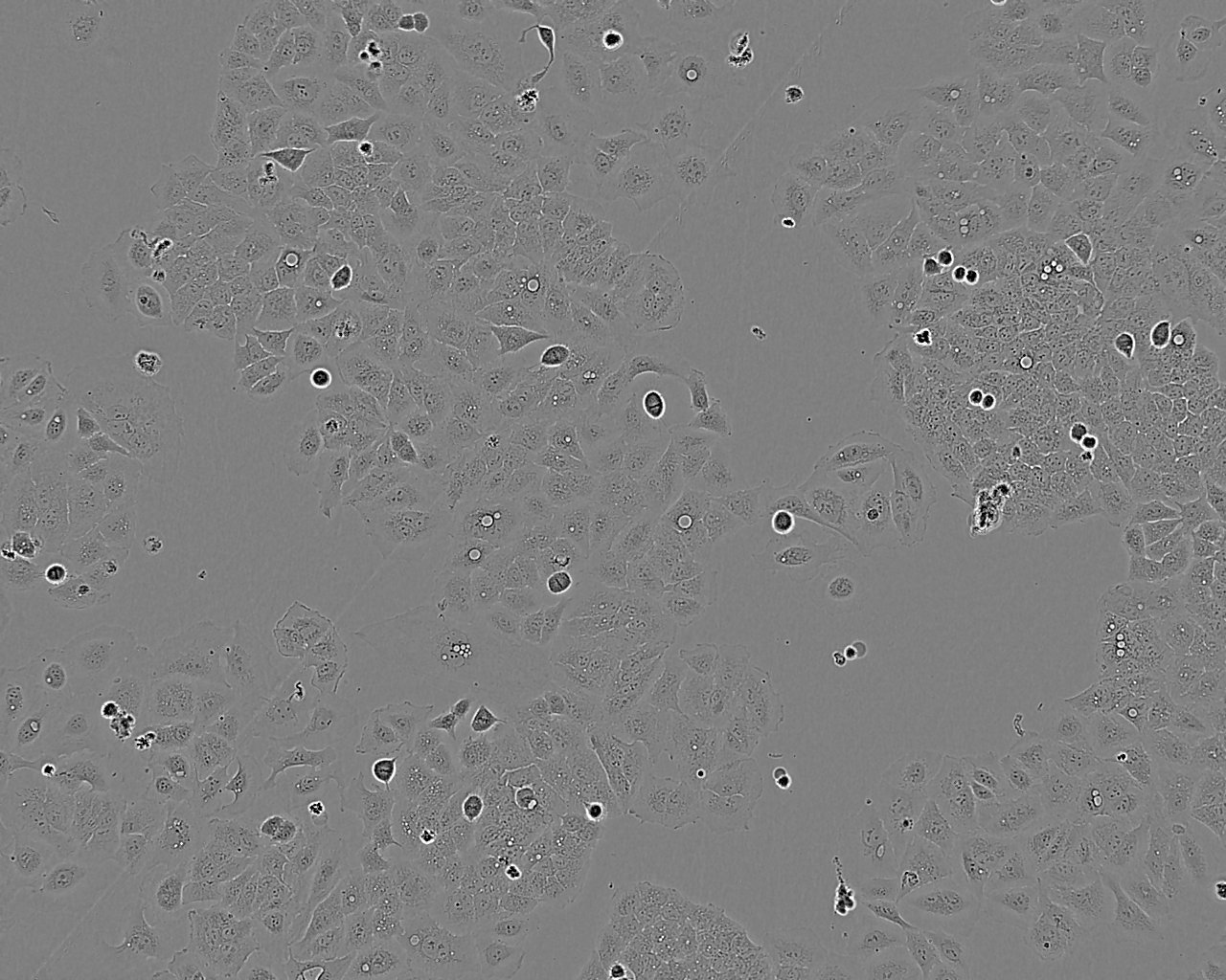SNU-886 Cell:人肝癌细胞系,SNU-886 Cell