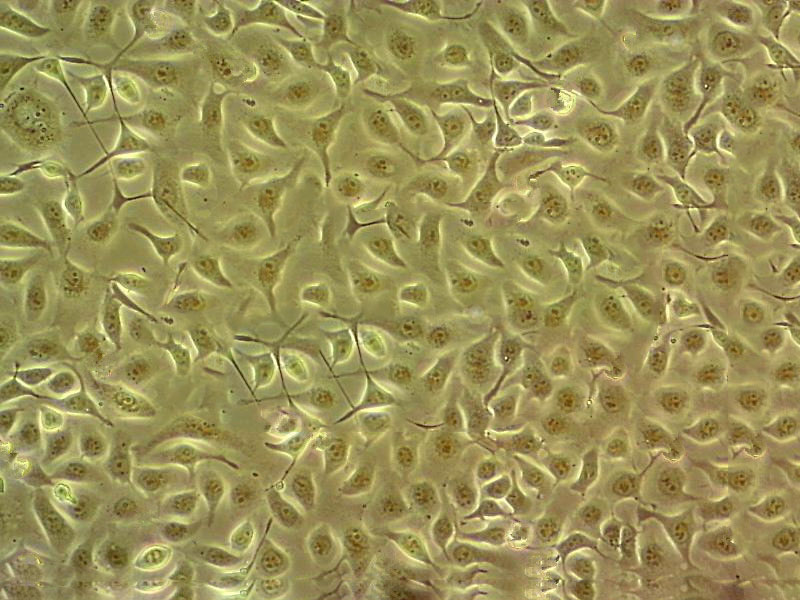 TE-10 Cell:人食管癌细胞系,TE-10 Cell