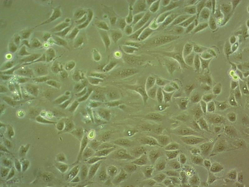 TE-14 Cell:人食管癌细胞系,TE-14 Cell