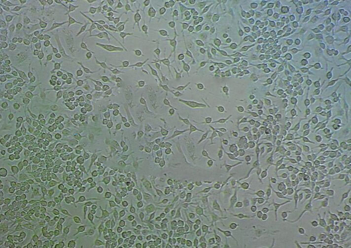 TE-9 Cell:人食管癌细胞系,TE-9 Cell