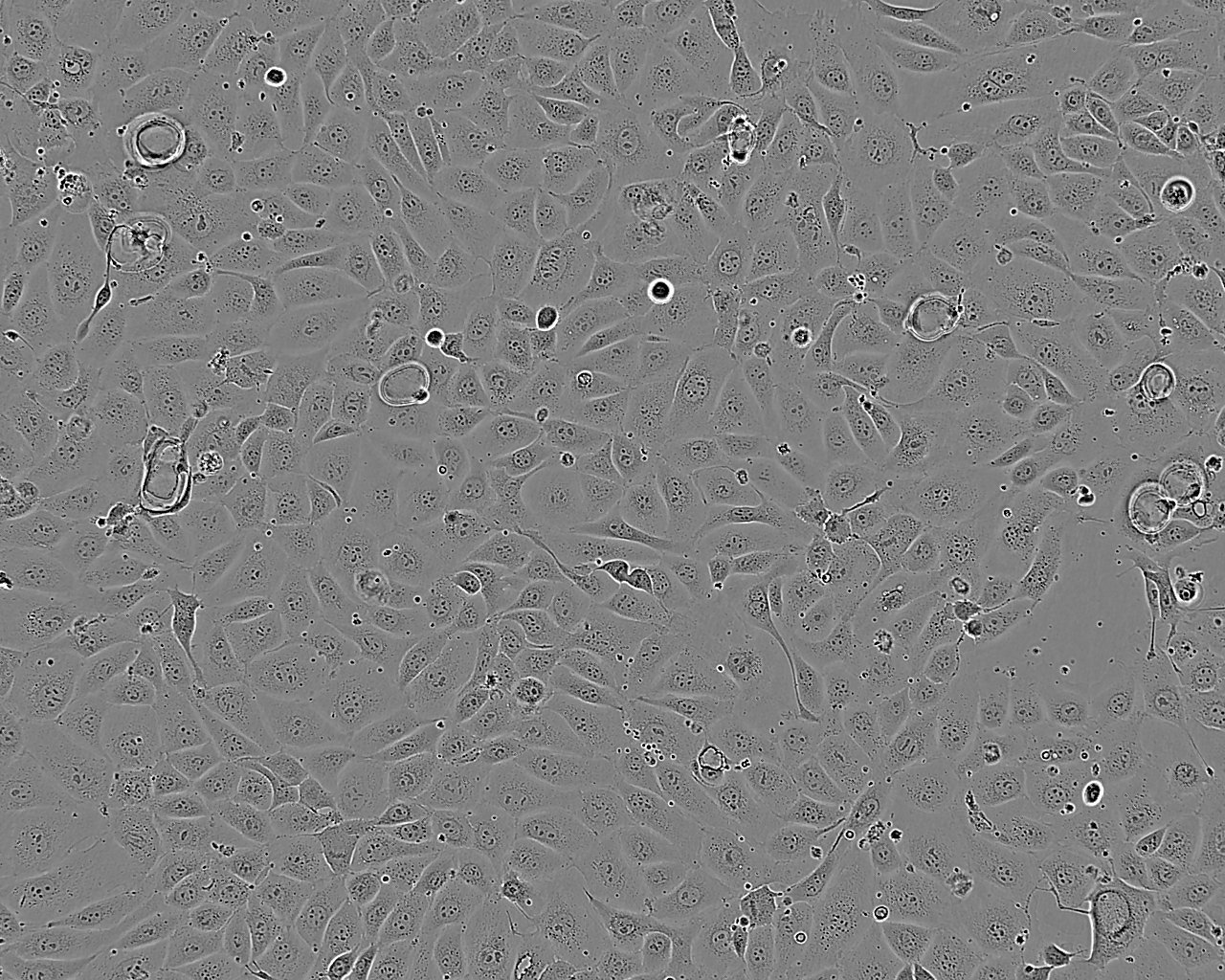 DMS 53 Cell:人小细胞肺癌细胞系,DMS 53 Cell