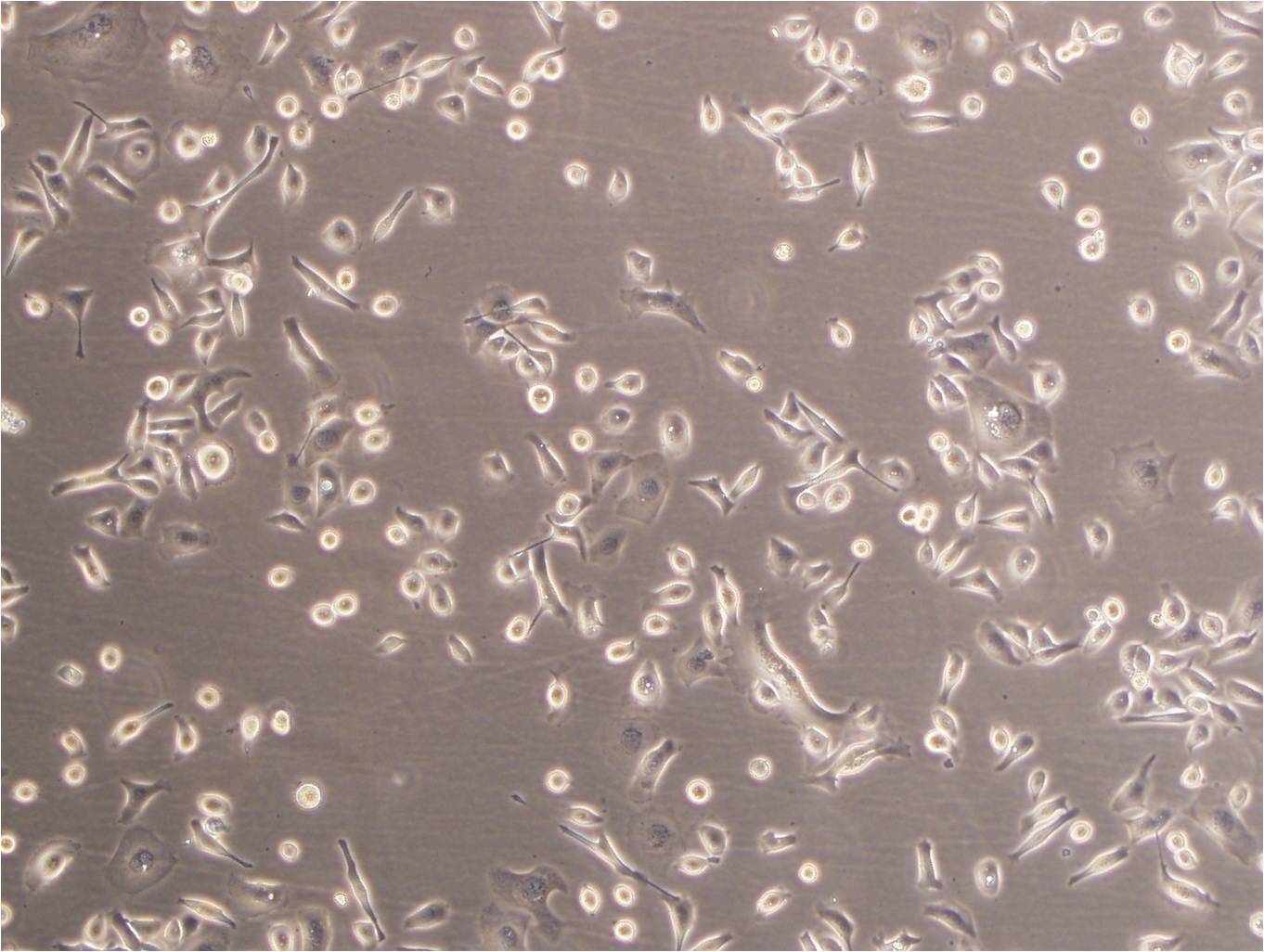 TC-1 [Mouse lung] Cell:小鼠肺上皮細胞系,TC-1 [Mouse lung] Cell