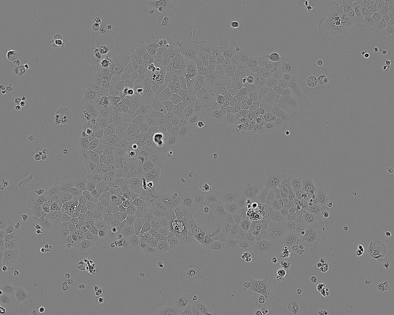 Tu 212 Cell:人喉癌细胞系,Tu 212 Cell