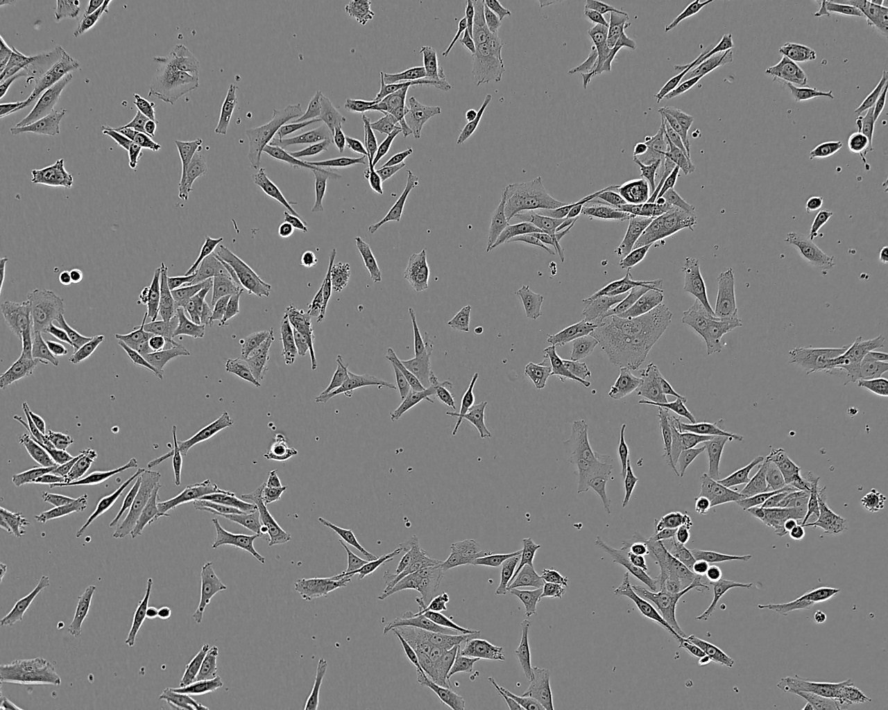 MC3T3-E1 Subclone 14 Cell:小鼠颅顶前骨细胞系,MC3T3-E1 Subclone 14 Cell