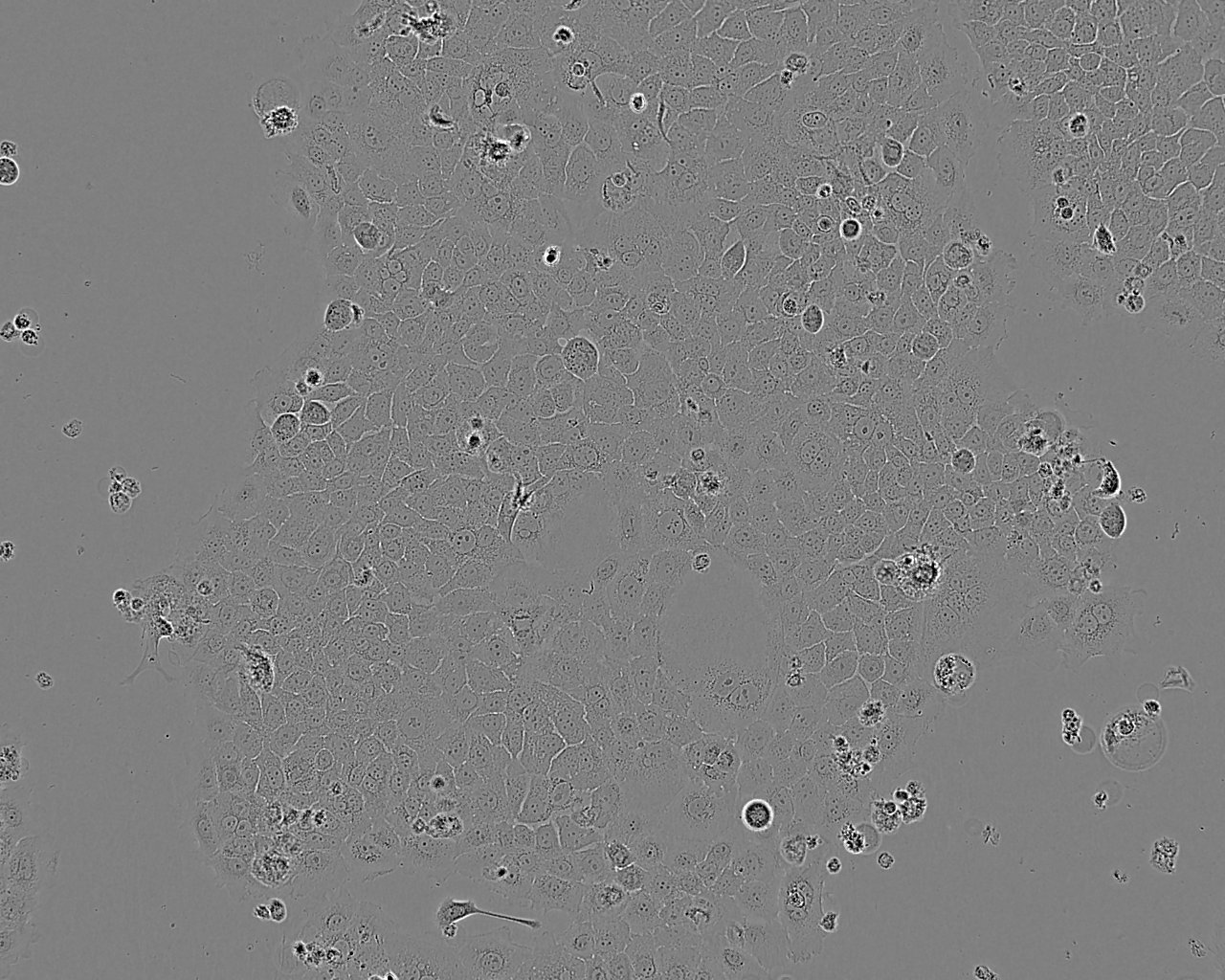 NCTC 1469 Cell:小鼠正常肝细胞系,NCTC 1469 Cell