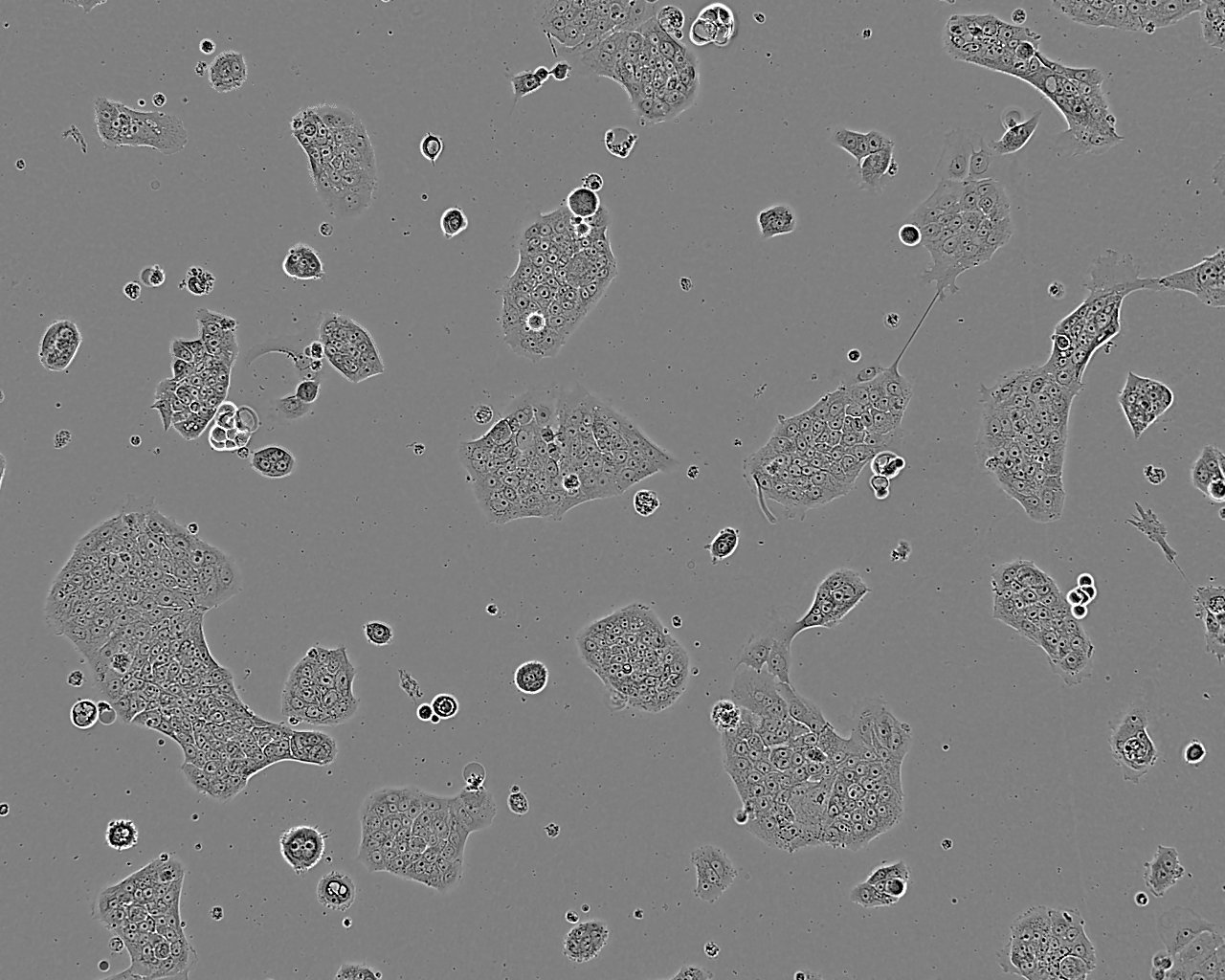 HEK293T/17 Cell:人胚肾细胞系,HEK293T/17 Cell