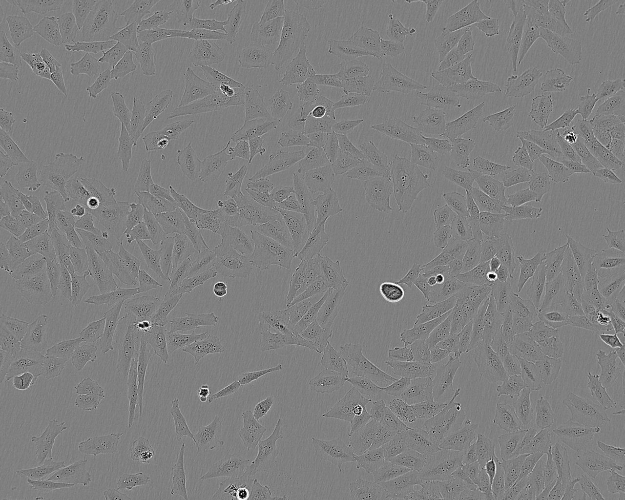 PA317 Cell:逆轉(zhuǎn)錄病毒包被的NIH3T3細(xì)胞系,PA317 Cell