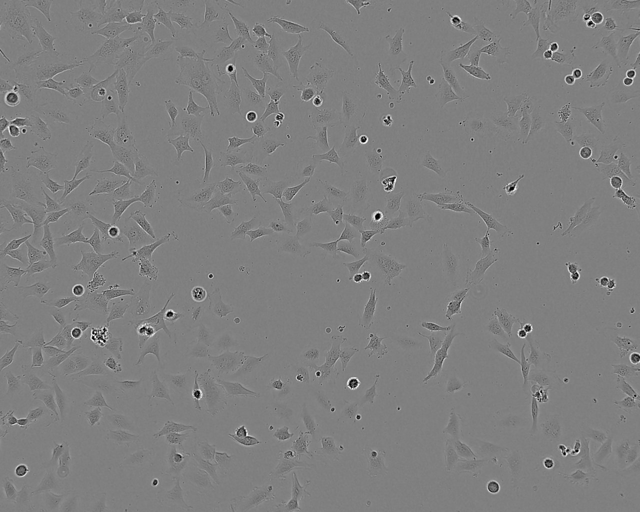 OV3121 Cell:小鼠卵巢颗粒细胞系,OV3121 Cell