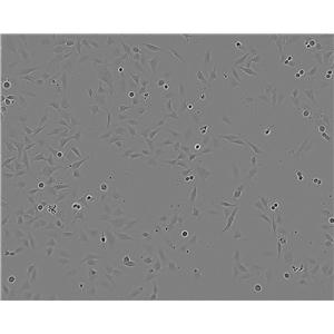 OV3121 Cell:小鼠卵巢颗粒细胞系