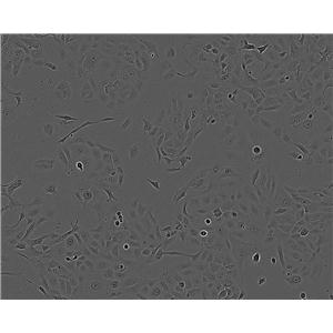 SNU-407 Cell:人结肠癌细胞系