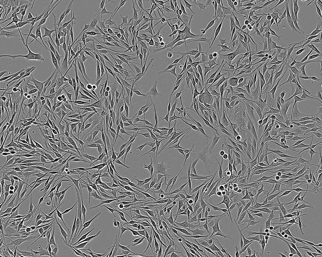 NCI-H1404 Cell:人乳头状腺癌细胞系,NCI-H1404 Cell