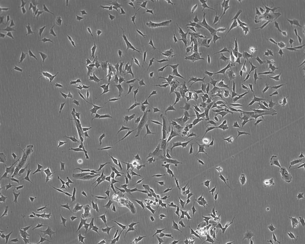 HECV Cell:人血管內(nèi)皮細(xì)胞系,HECV Cell