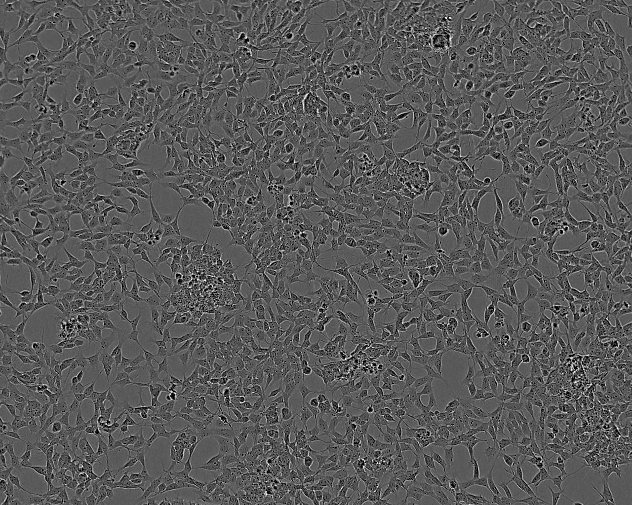 BJ [Human fibroblast] Cell:人皮膚成纖維細胞系,BJ [Human fibroblast] Cell