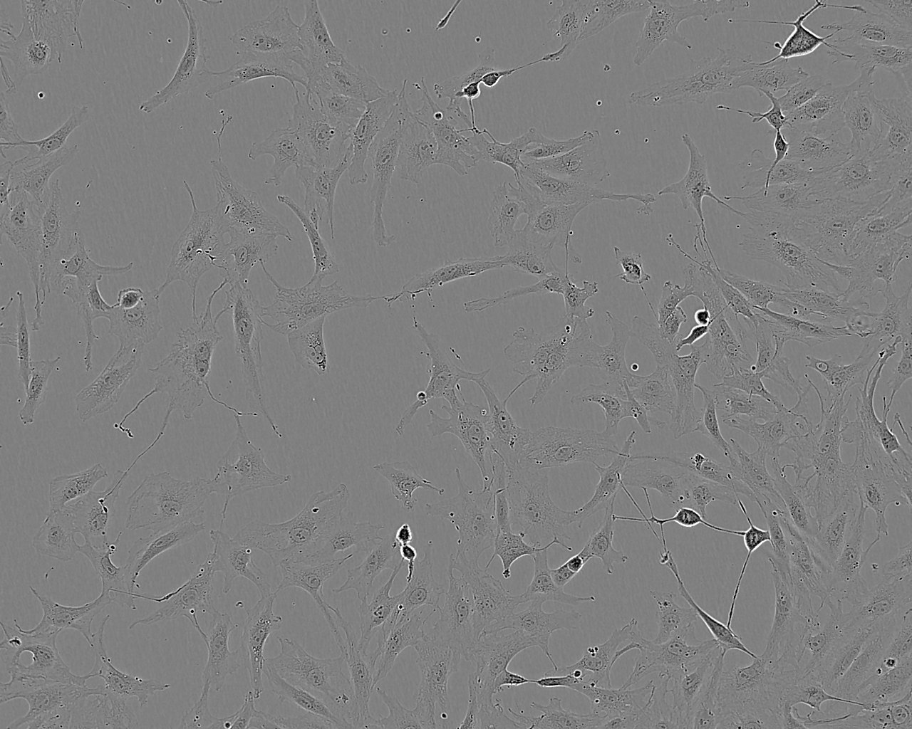PT-K75 Cell:猪鼻甲黏膜成纤维细胞系,PT-K75 Cell