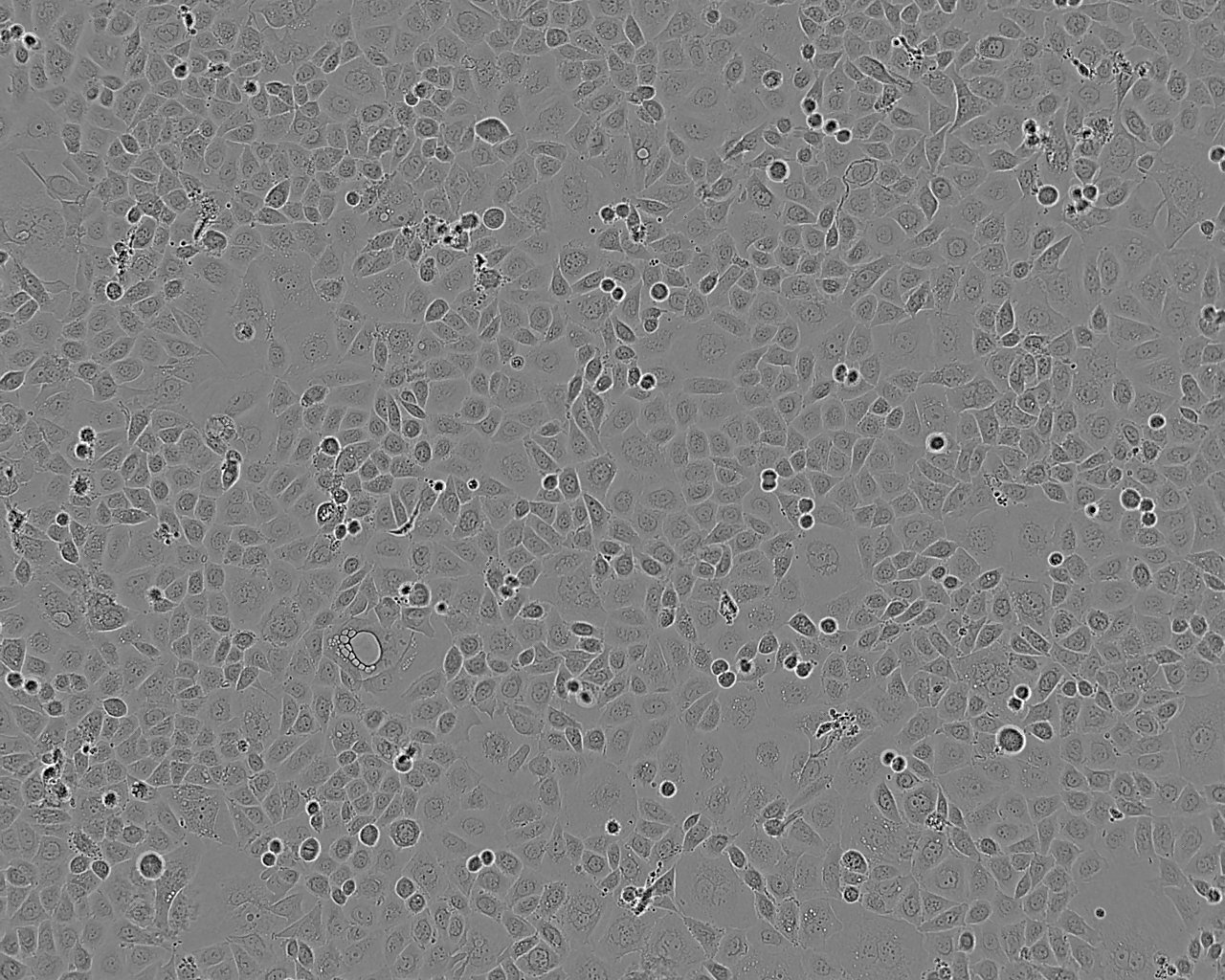 LNCaP C4-2B Cell:人前列腺癌细胞系,LNCaP C4-2B Cell