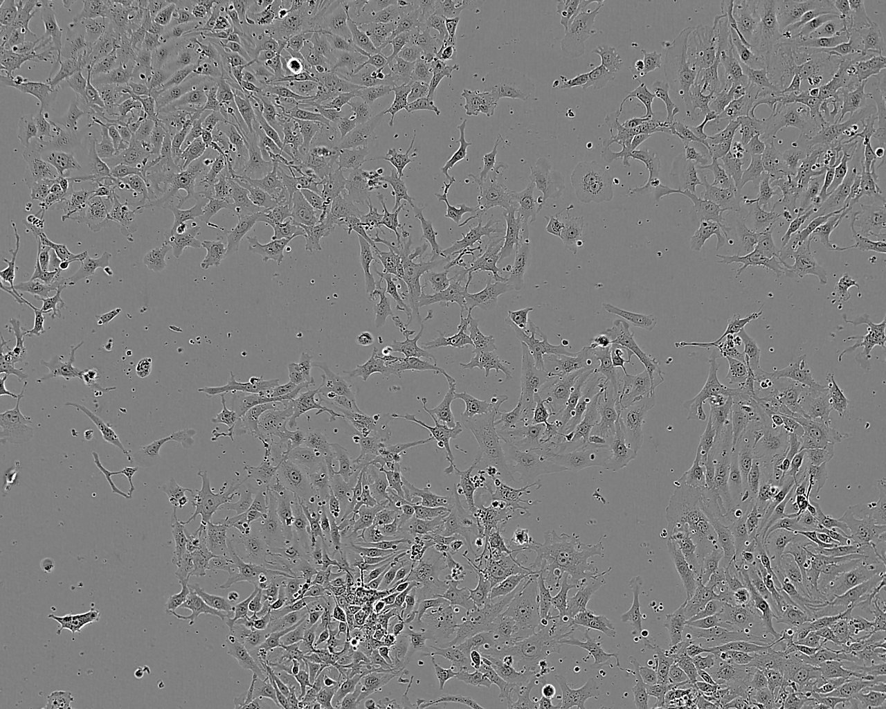 SCL-II Cell:人皮肤鳞癌细胞系,SCL-II Cell