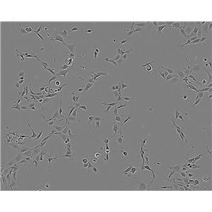 PC-10 Cell:人肺鳞癌细胞系