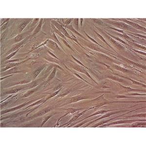 3T3-L1 Cell:小鼠前脂肪胚胎成纤维细胞系